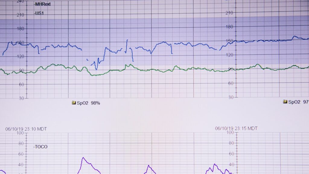 Informal Contractions