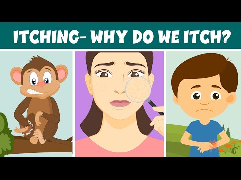Itching- Why do we Itch? – Remedies and Treatment – Video for Kids